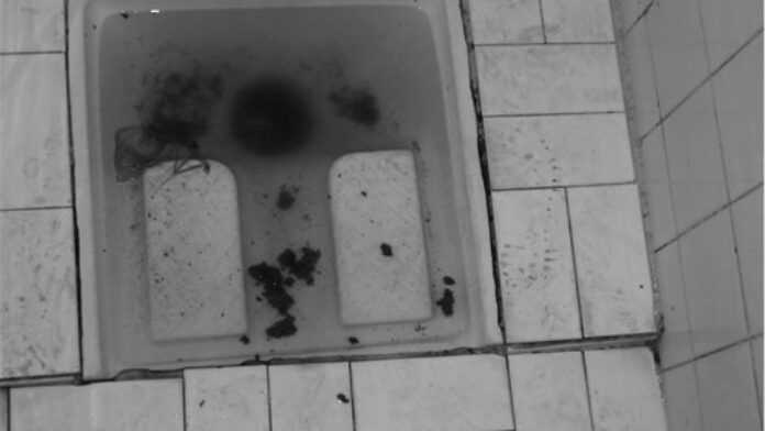 L’hygiène inquiétante dans les toilettes des stations-services de Dakar