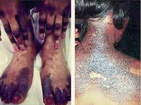 La beauté à tout prix pour les femmes sénégalaises