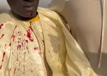 Les Forces de l’ordre dispersent les partisans de Farba Ngom