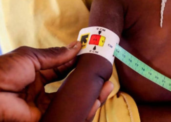 A Diourbel : la malnutrition touche plus de 50 000 nourrissons